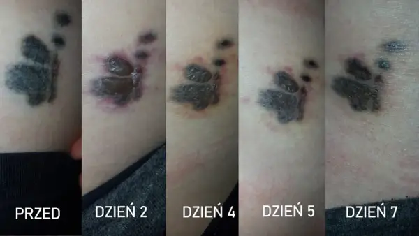 Postęp usuwania tatuażu łapy: od świeżej rany po gojenie. Dzień 2, 4, 5, 7.