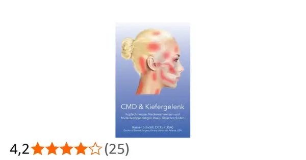 Kopfschmerzen und verspannte Kopfmuskulatur lockern: Illustration zeigt Schmerzpunkte am Kopf und Kiefer.