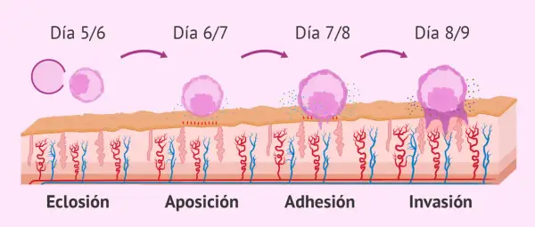Ilustración de la implantación embrionaria: eclosión, aposición, adhesión e invasión del blastocisto en el endometrio.