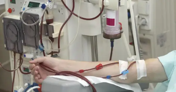 Ramię pacjenta podłączone do maszyny do dializy. Czerwone i niebieskie złącza przewodów widoczne na skórze.