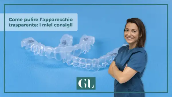 Consigli su come pulire l'apparecchio trasparente. Una donna sorride accanto a un apparecchio dentale trasparente.