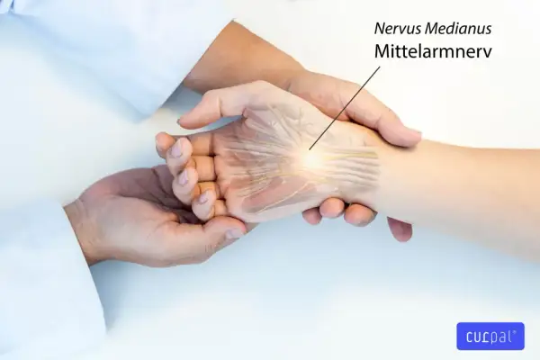 Ärzte prüfen das Hoffmann-Tinel-Zeichen am Handgelenk, um den Nervus medianus (Mittelarmnerv) zu untersuchen.