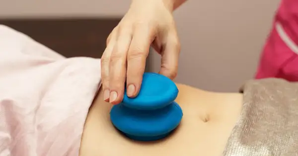 Dłoń terapeuty wykonuje masaż brzucha niebieskimi bańkami. Choć masaż bańką chińską efekty uboczne są rzadkie, warto znać potencjalne skutki.