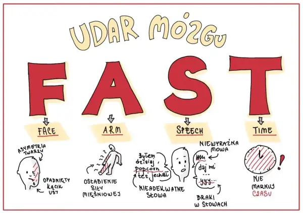 FAST - objawy udaru mózgu: opadnięta twarz, osłabienie ręki, niewyraźna mowa, brak czasu.