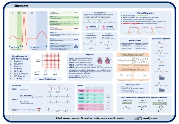 EKG-Schema erklärt Herzinfarkt-Anzeichen: ST-Strecken-Veränderungen wie bei STEMI, Perikarditis oder Tachykardien.