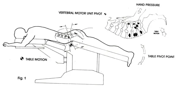 Ilustracja pokazuje technikę terapii manualnej kręgosłupa, która może pomóc w odpowiedzi na pytanie: czy wypuklina może się cofnąć.