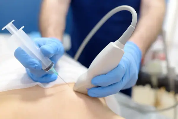 Lekarz w niebieskich rękawiczkach wykonuje biopsję mammotomiczną pod kontrolą USG.