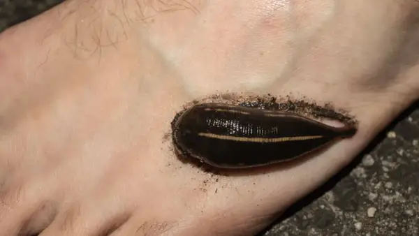 Une sangsue de rivière s'est accrochée au pied, une rencontre désagréable lors d'une baignade.