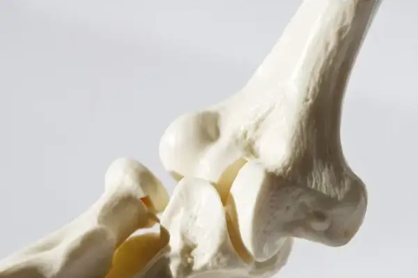 Jaki lek na osteoporozę? Poznaj skuteczne opcje leczenia i ich działanie