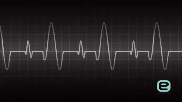 Nieregularny zapis EKG na czarnym tle. Pokazuje, jakie są objawy arytmii serca, gdy rytm jest zaburzony.
