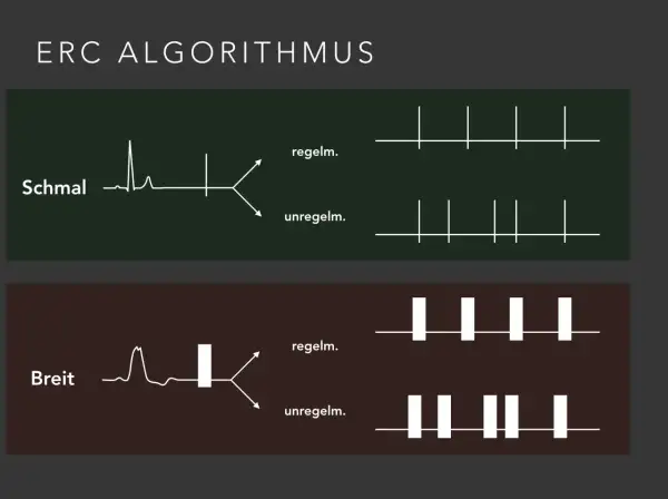 ERC Algorithmus: Schmale und breite QRS-Komplexe, die zu regelmäßigen oder unregelmäßigen Rhythmen führen. Diese Unterscheidung ist wichtig für die Behandlung von nicht defibrillierbare Rhythmen.