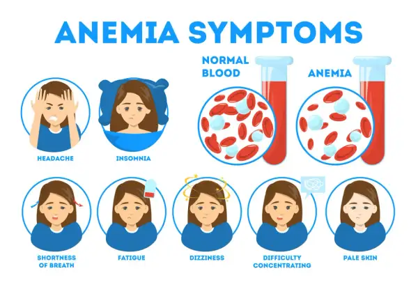 Sintomi di anemia: mal di testa, insonnia, affanno, stanchezza, vertigini, difficoltà di concentrazione, pelle pallida. Il ferro basso quando preoccuparsi è indicato da questi segnali.