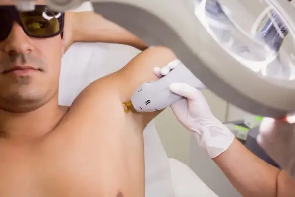 Depilacja laserowa: Bezpieczeństwo, mity i jak uniknąć ryzyka