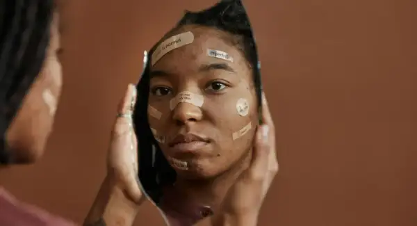 Riflesso di un volto con cerotti che recitano "acne is normal", "imperfect", "i'm not my skin", quando ti fanno sentire una nullità.