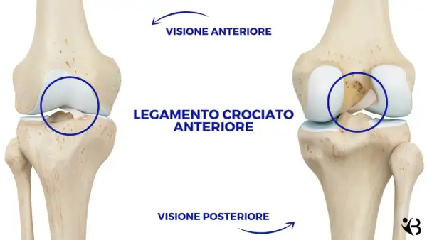 Illustrazione anatomica del ginocchio che mostra il legamento crociato anteriore. Visione anteriore e posteriore per il recupero legamento crociato anteriore senza intervento.