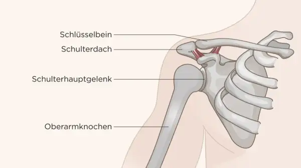 Anatomie der Schulter: Schlüsselbein, Schulterdach, Schulterhauptgelenk und Oberarmknochen. Die Heilung des Schulter-Arm-Syndroms kann variieren.