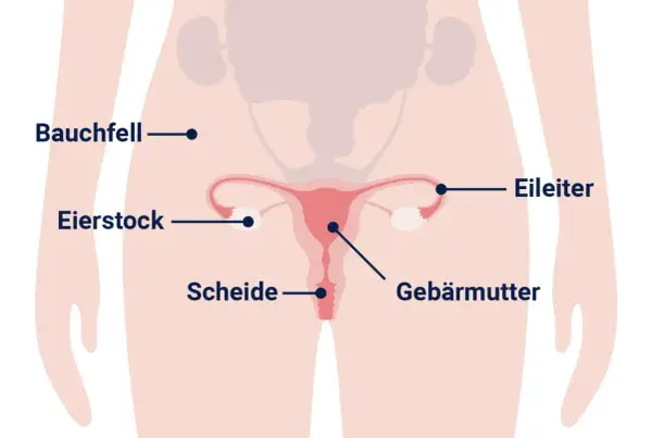 Anatomische Darstellung des weiblichen Beckens mit Gebärmutter, Eierstöcken und Eileitern. Informationen zu Eierstockkrebs, woran stirbt man, sind hier nicht ersichtlich.