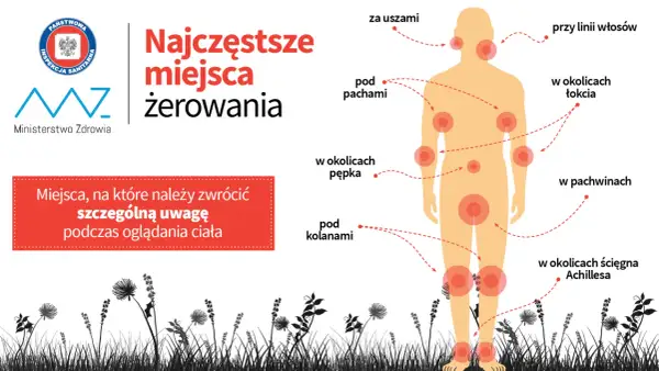Najwięcej kleszczy żeruje za uszami, pod pachami, w okolicach łokci, pępka, pachwin, pod kolanami i ścięgna Achillesa.
