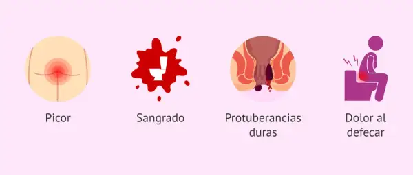 Síntomas de hemorroides postparto: picor, sangrado, protuberancias duras y dolor al defecar.