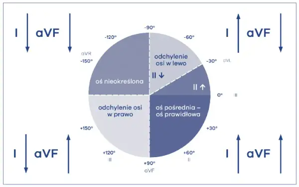 Lewogram patologiczny EKG: Co to znaczy? Przyczyny i co dalej