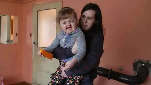 Matka trzyma dziecko z zespołem Aperta. Dziewczynka ma pomarańczową zabawkę.