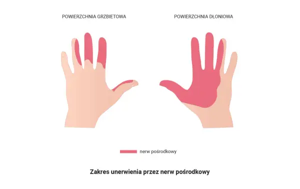 Obszar unerwienia przez nerw pośrodkowy na grzbietowej i dłoniowej stronie dłoni. Może to być związane z drganiem mięśni.