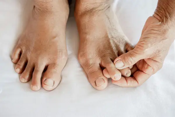 Nahaufnahme von Füßen mit Hammerzehen. Eine Hand berührt sanft die Zehen, die eine gekrümmte Form aufweisen.