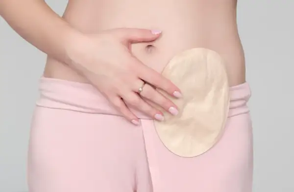 Eine Hand bedeckt einen Teil einer Stoma-Blase, die an der Hüfte einer Person befestigt ist.