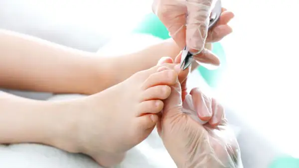 Pedicure: usuwanie skórek wokół paznokci u stóp, które mogą przypominać paznokcie rurkowate.