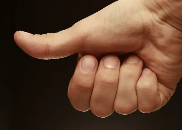 Main d'une personne montrant le pouce, comme pour donner un avis positif. La prothèse du pouce avis est ici symbolisée par ce geste.