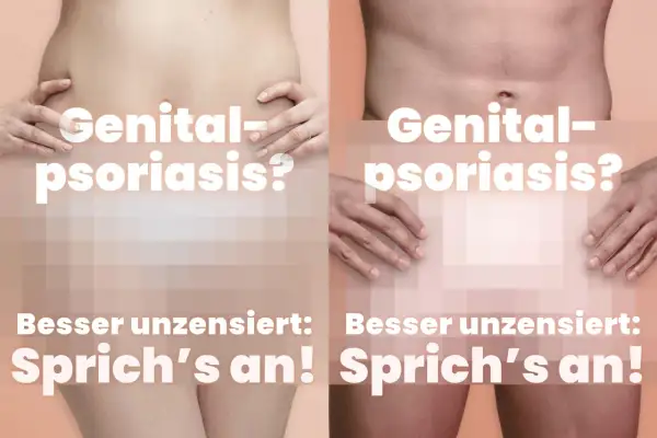 Genital-Psoriasis? Zwei Körper zeigen, dass es besser ist, offen darüber zu sprechen.