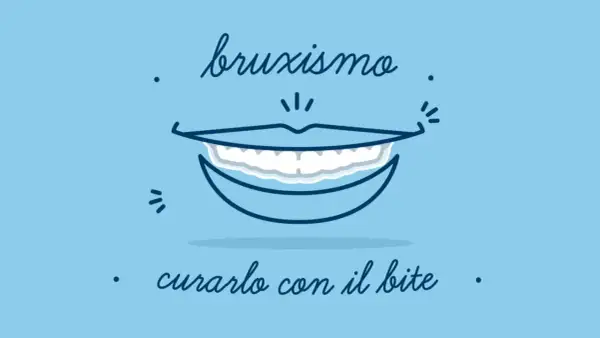 Bruxismo: un sorriso che stringe i denti. Scopri i rimedi, come il bite, per alleviare il serramento notturno.