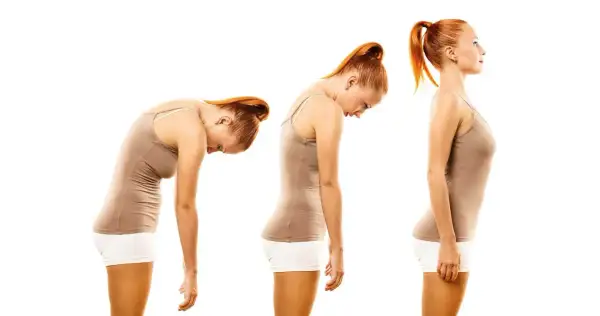 Tre pose a confronto: una donna con postura scorretta in piedi, poi leggermente meglio, e infine con postura corretta in piedi.