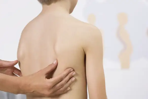 Mani di un medico esaminano la schiena di un bambino, evidenziando una possibile scoliosi cervicale.