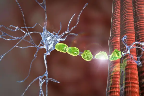 Danno alla mielina neuronale, simile a quello osservato nella Charcot-Marie-Tooth, con fibre nervose e muscolari.