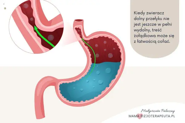 Ilustracja pokazuje żołądek i przełyk, gdzie treść żołądkowa cofa się do góry. To wyjaśnia problem refluksu u niemowlaka.