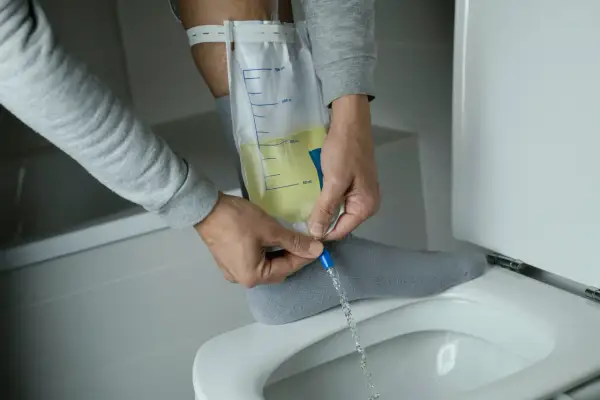 Mann entleert Urinbeutel, der mit einem Bauchdeckenkatheter verbunden ist. Erfahrungen damit sind oft eine Umstellung.