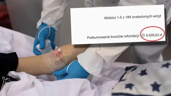 Podsumowanie kosztów refundacji: 6 830,63 zł. Czy to koszt zabiegu entropium?