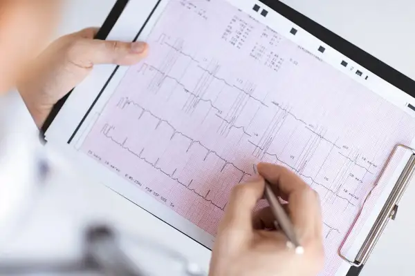 Ręka z długopisem wskazuje na zapis EKG, pomagając zrozumieć, jak odczytać wynik ekg.