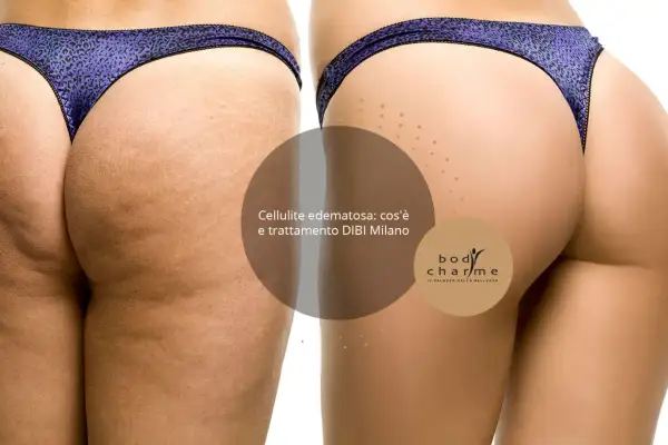 Confronto prima/dopo: la pelle mostra i diversi tipi di cellulite, con un miglioramento visibile grazie al trattamento DIBI Milano.