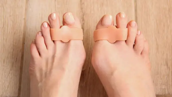 Separatori per dita dei piedi per correggere l'alluce valgo inizio.