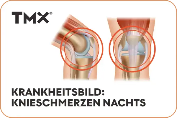 Anatomische Darstellung von Kniegelenken, die **Knieschmerzen nachts** thematisieren.
