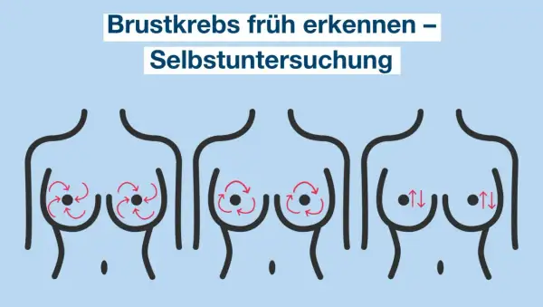 Brustkrebs früh erkennen durch Selbstuntersuchung. Illustration zeigt drei Brüste mit roten Pfeilen, die verschiedene Abtasttechniken darstellen.