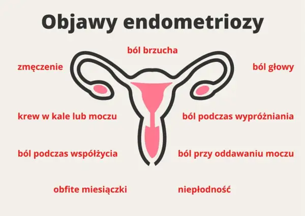 Objawy endometriozy: ból brzucha, zmęczenie, krew w kale/moczu, ból głowy, ból podczas wypróżniania, ból przy oddawaniu moczu, ból podczas współżycia, obfite miesiączki, niepłodność.