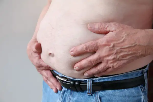 Osoba z zaawansowaną marskością wątroby, widoczny duży brzuch i dłonie obejmujące go.