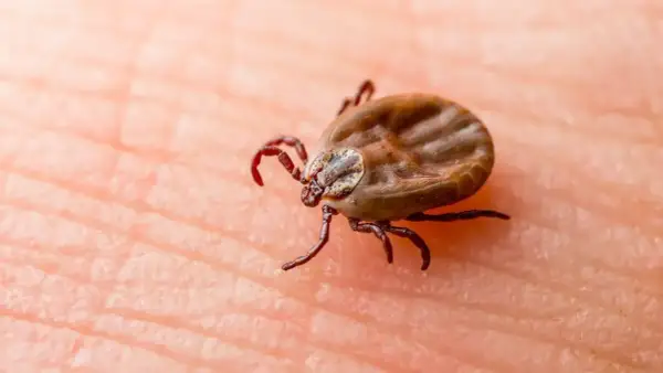Kleszcz na skórze, potencjalne źródło choroby z Lyme.