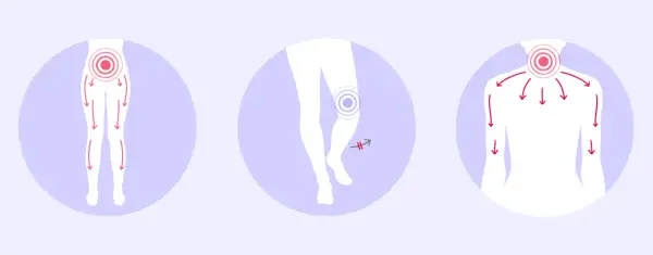 Schmerzhafte Ausstrahlung in Beine und Arme, Knie- und Nackenbeschwerden – typische spinalkanalstenose symptome.