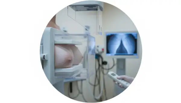 Mammografia w wieku 30 lat to ważny krok w dbaniu o zdrowie. Badanie wykonane w gabinecie diagnostycznym.