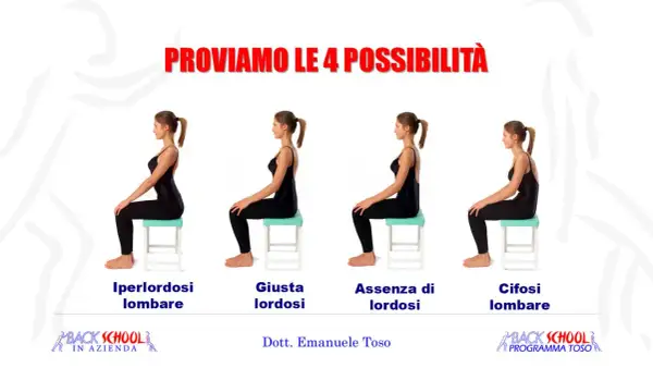 Quattro posture a confronto: iperlordosi lombare, lordosi corretta, assenza di lordosi e cifosi lombare. Utile per esercizi posturali.