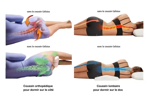 Comparaison de la posture du dos sans et avec coussin. Aide à soulager la douleur lombaire la nuit et le matin.